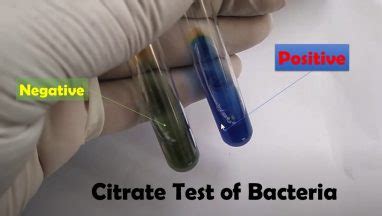 citrate utilization test|citrate negative bacteria list.